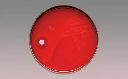 BD Differentiation Disc BBL™ Taxo™ P Optochin 5.0 µg - M-17313-4221 - Pack of 10