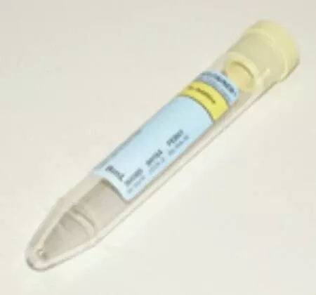 Becton Dickinson BD Vacutainer Urinalysis Tube Conical Bottom Plain 16 X 100 mm 8 mL Yellow Conventional Closure Plastic Tube - M-402053-3494 - Box of 100