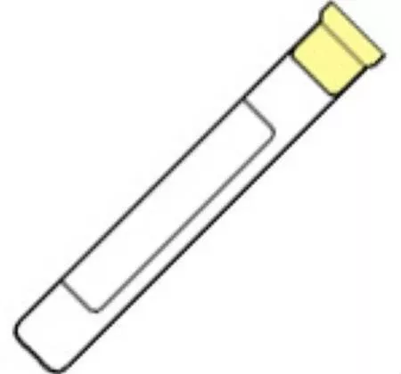 Becton Dickinson BD Vacutainer Venous Blood Collection Tube Whole Blood Tube ACD Solution A Additive 16 X 100 mm 8.5 mL Yellow Conventional Closure Glass Tube - M-248-1802 - Box of 100