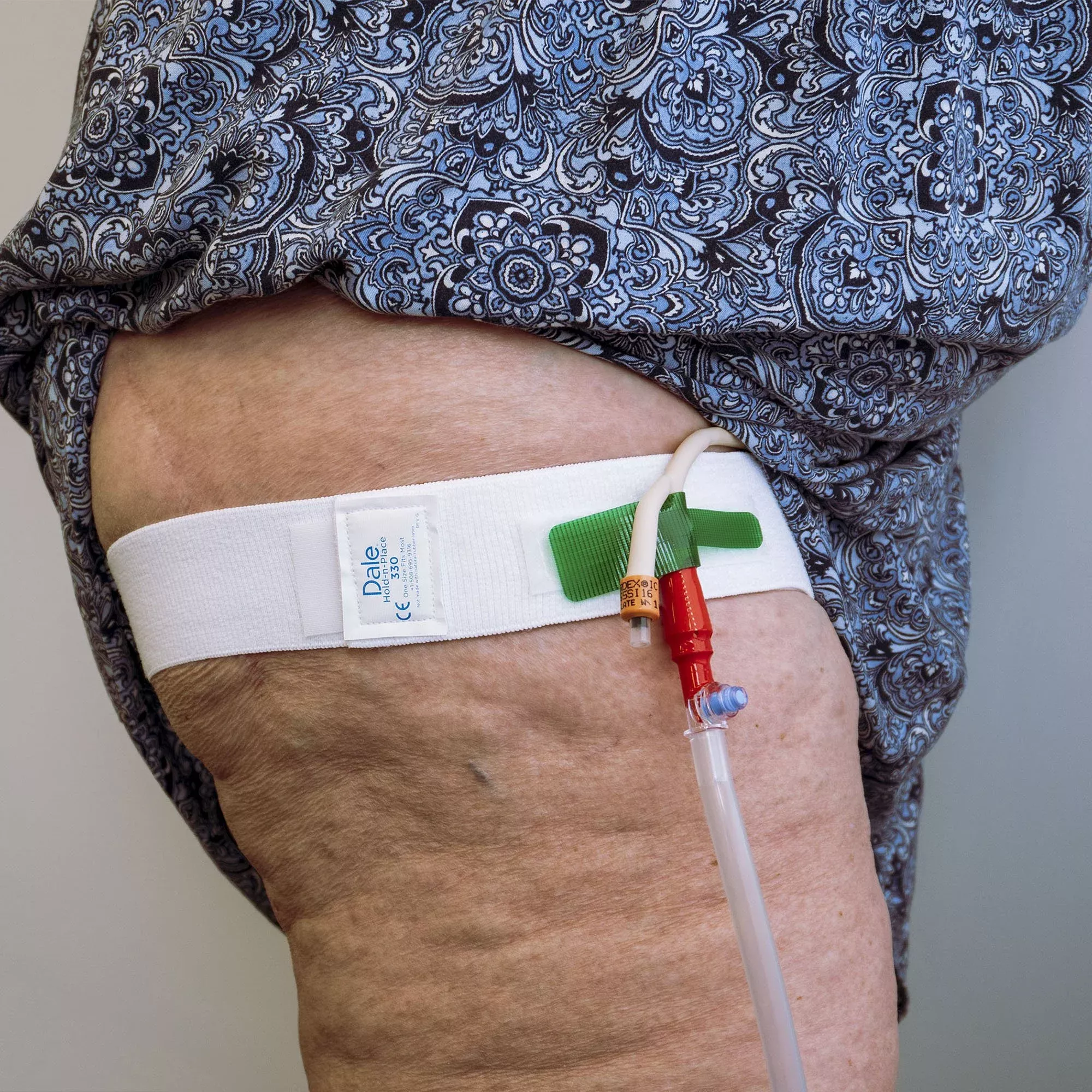 Dale Leg Strap/Waist Band, holds Catheter, fits legs and waists up to 56 Inches