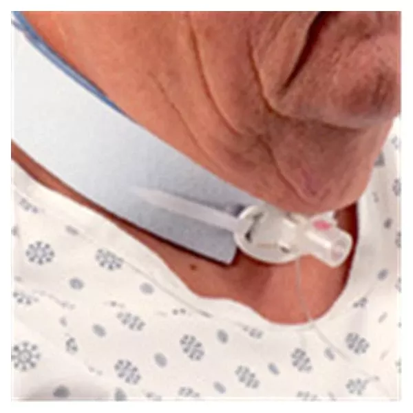 Dale Medical ProductsBand Neck/Chin Blue 10/Bx