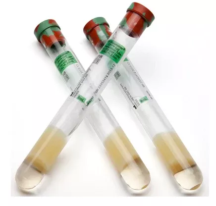 Fisher Scientific BD Vacutainer CPT™ Molecular Diagnostic Tube Cell Preparation Sodium Heparin / Separator Gel Additive 16 X 125 mm 8 mL Green / Red Mottled Conventional Closure Glass Tube - M-1007554-2262 - Case of 60