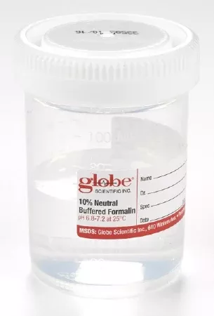 Globe Scientific Prefilled Formalin Container Tite-Rite™ 53 X 63 mm Polypropylene 60 mL Fill in 120 mL (4 oz.) Screw Cap Warning Label / Patient Information NonSterile - M-1124676-2339 - Case of 96