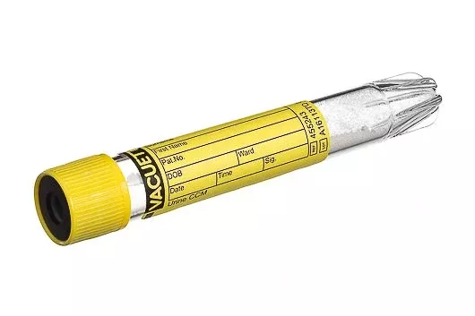 Greiner Bio-One VACUETTE Urinalysis Tube Conical Bottom CCM (Count and Culture Mannitol) Additive 16 X 100 mm 9 mL Yellow / Black Ring Pull Cap Polyethylene Terephthalate (PET) Tube - M-1064093-2368 - Case of 1200