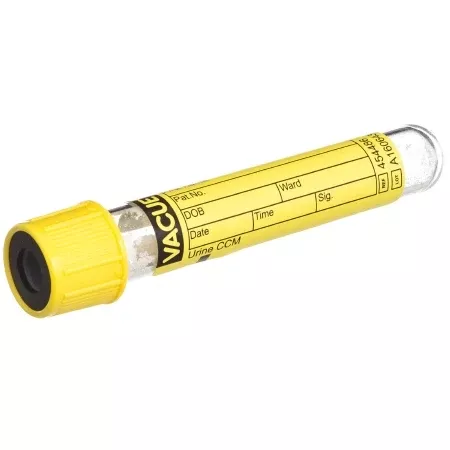 Greiner Bio-One VACUETTE Urinalysis Tube Round Bottom CCM (Count and Culture Mannitol) Additive 13 X 75 mm 4 mL Yellow / Black Ring Pull Cap Polyethylene Terephthalate (PET) Tube - M-1064091-3616 - Case of 1200