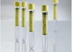 Greiner Bio-One VACUETTE Urinalysis Tube Round Bottom Plain 13 X 100 mm 6.5 mL Yellow Screw Cap Polyethylene Terephthalate (PET) Tube - M-507448-3685 - Case of 1200