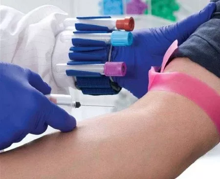 Market Lab Inc Tube Jockey Wristband / Holder Set For Holding 13 - 16 mm Tubes - M-905960-906 - Each