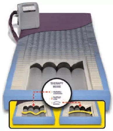 Span America Alternating Pressure Mattress PressureGuard Easy Air™ LR Alternating Pressure System 7 X 35 X 80 Inch - M-702908-3796 - Each
