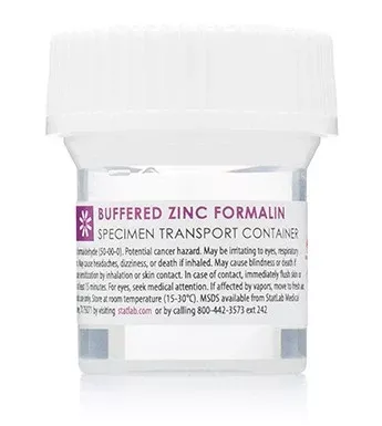 StatLab Medical Products Prefilled Formalin Container StatClick™ Polypropylene 20 mL Fill in 40 mL (1.35 oz.) Screw Cap Warning Label NonSterile - M-1002257-1195 - Case of 96