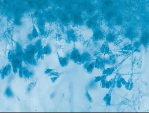 Ward's Science Teaching Microscope Slide Conidiophore Penicillum with Conidia Slide 1 X 3 Inch - M-959216-511 - Each